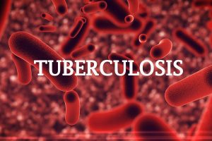 FG, groups alerts on prevalence of Tuberculosis among children in Anambra